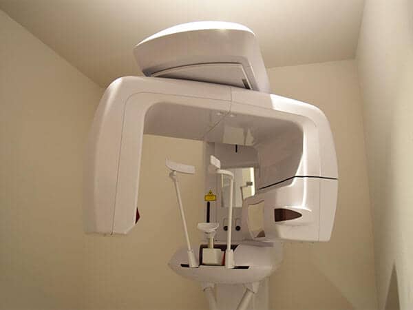 STEP3 : ご希望の方は歯科用CTなど、詳しい診査・診断を行います